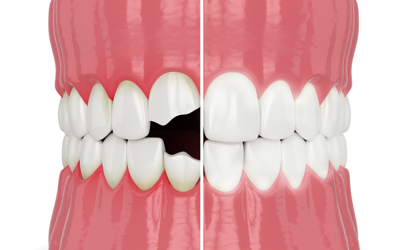 Boost Your Confidence with Cosmetic Dentistry